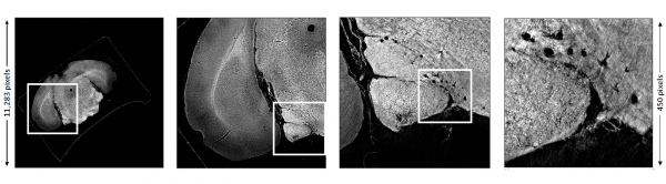 Micrometer-resolution CT of a mouse brain with 127.3 million pixels produced by MemXCT. It takes a supercomputer and scalable algorithms to perform iterative image reconstruction just in 10 seconds. 