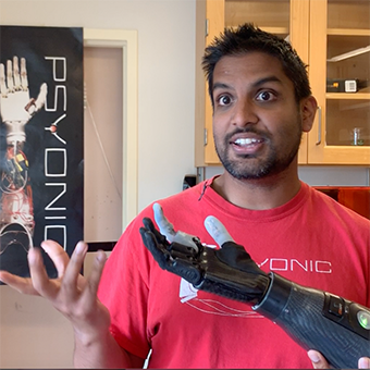 CSL Alumnus launches the first commercially available bionic hand ...